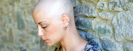 Chemoterapie